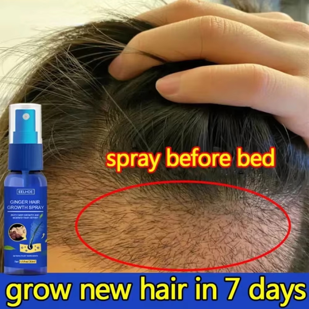 Hair Care Lotion - สเปรย์เร่งผมยาวขึ้นอย่างรวดเร็ว บำรุงรากผม ป้องกันผมร่วง เซรั่มปลูกผมใหม่ ซ่อมแซมหนังศีรษะที่เสียหาย บำรุงและดูแลเส้นผม