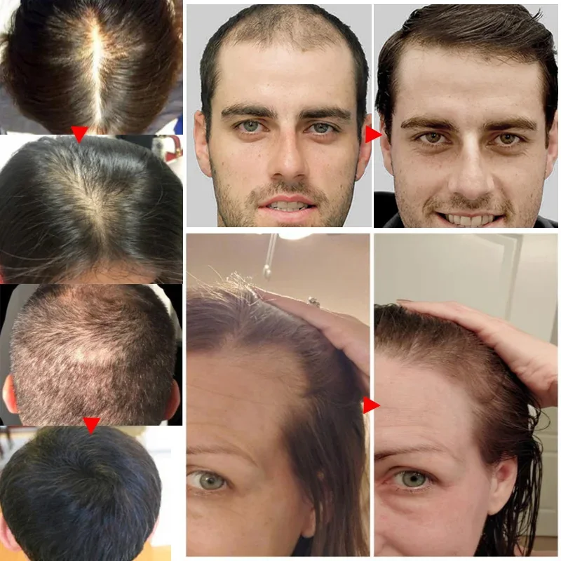 เซรั่มปลูกผมร่วงน้ำมัน Essenti - Hair Care Essential Oil Atomizing บทวิจารณ์และราคา
