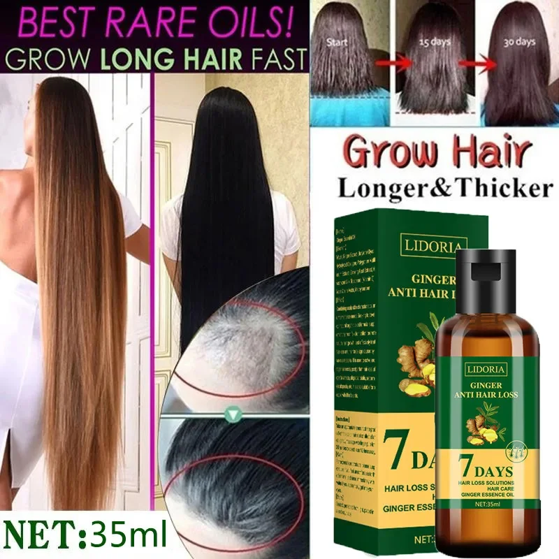 เซรั่มปลูกผมร่วงน้ำมัน Essenti - Hair Care Essential Oil Atomizing บทวิจารณ์และราคา