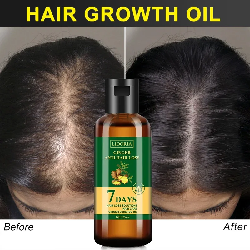 เซรั่มปลูกผมร่วงน้ำมัน Essenti - Hair Care Essential Oil Atomizing บทวิจารณ์และราคา