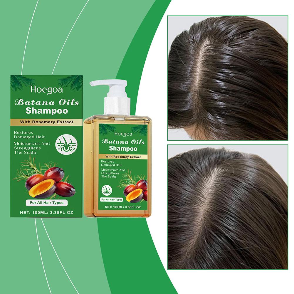 แชมพูบาตานาออยล์และโรสแมรี่ 10 - Rosemary Hair Oil บทวิจารณ์และราคา