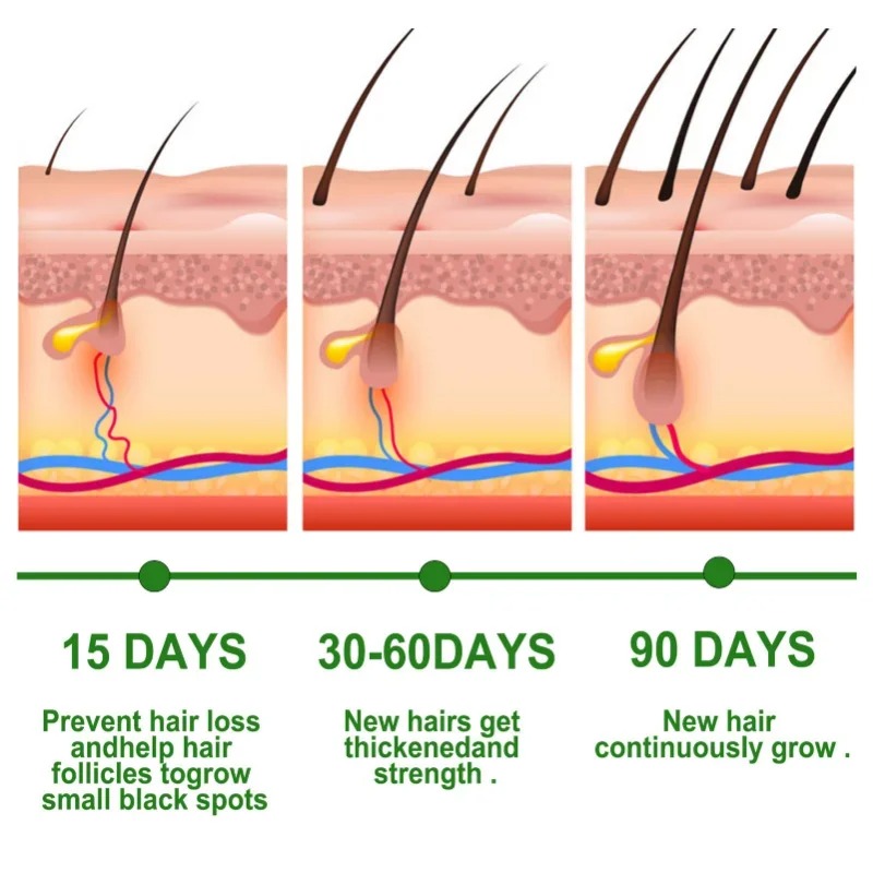 Hair Growth Serum Fast Growing - Hair Care Essential Oil Atomizing บทวิจารณ์และราคา