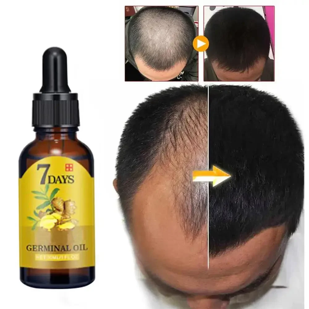 Hair Growth Ginger Fast Growin - Hair Care Essential Oil Atomizing บทวิจารณ์และราคา