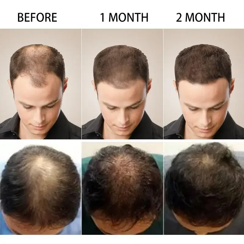 Hair Growth Ginger Fast Growin - Hair Care Essential Oil Atomizing บทวิจารณ์และราคา